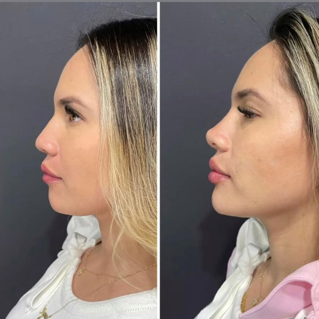 Perfilzinho- nariz, boca e queixo