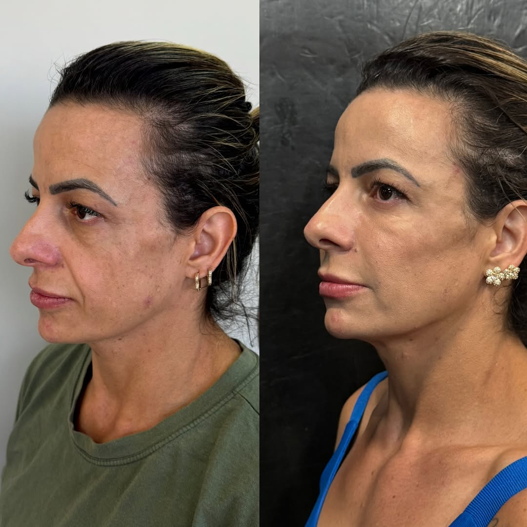 Junny, é uma mulher que faz muito crossfit, e, com esse esporte de alta performance, traz- emagr